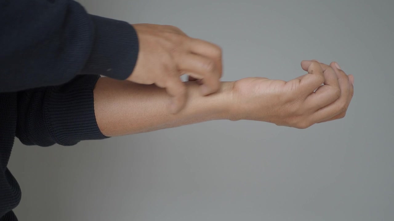 Close-up of Hand Scratching Itchy Forearm