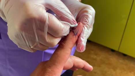 doctor or nurse inspects healing finger with gentle touch during follow up in clinic room