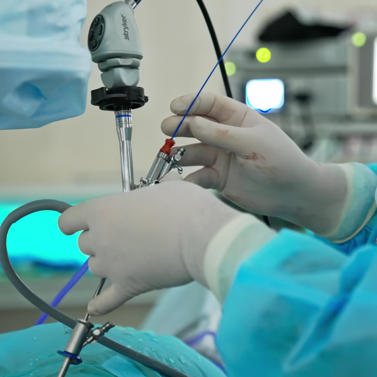 Professional surgery specialists working with instruments. Surgeon hands doing operation process