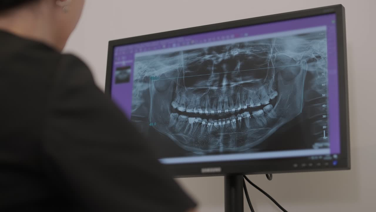el médico dentista examina una radiografía panorámica de la mandíbula en una pantalla de computadora. el médico muestra un modelo 3d de la boca del paciente, una resonancia magnética. equipo de diagnóstico de dientes en una clínica dental moderna.