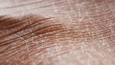 Close Up of Dry, Wrinkled Skin