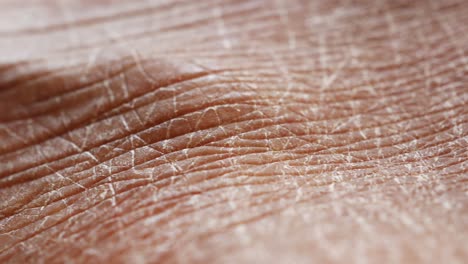 close up of dry, wrinkled skin