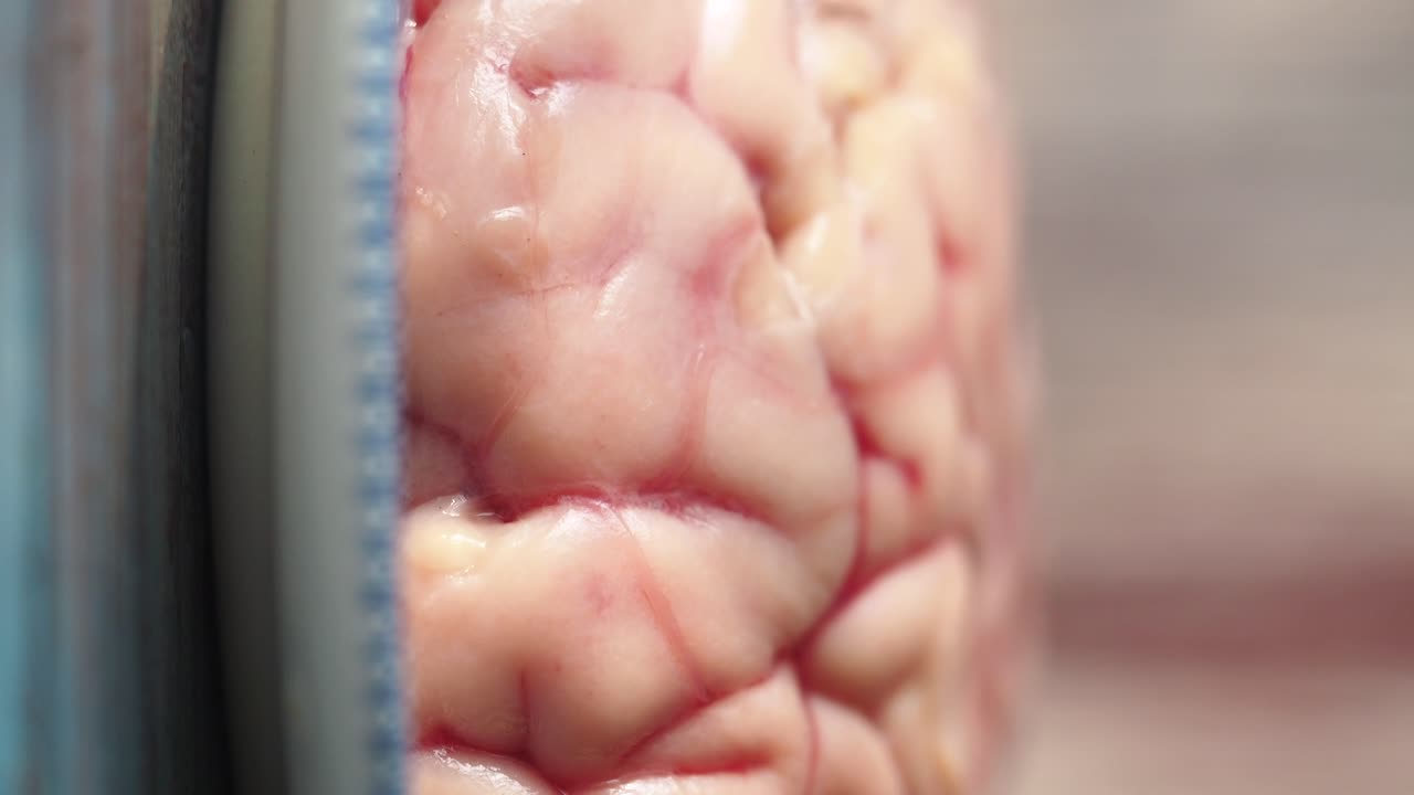 Close-up view of a raw brain