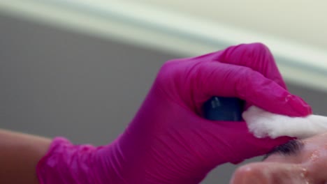 preparando la cara de una mujer para las inyecciones de botox