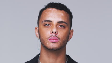 Waist-Up-Studio-Shot-Of-Young-Man-With-Skin-Pigmentation-Disorder-Smiling-At-Camera-In-Slow-Motion