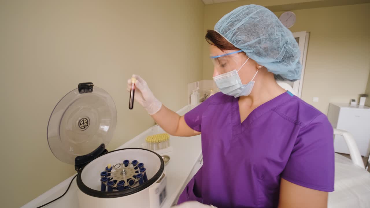 preparación de plasma rico en plaquetas. tubo con sangre en las manos.