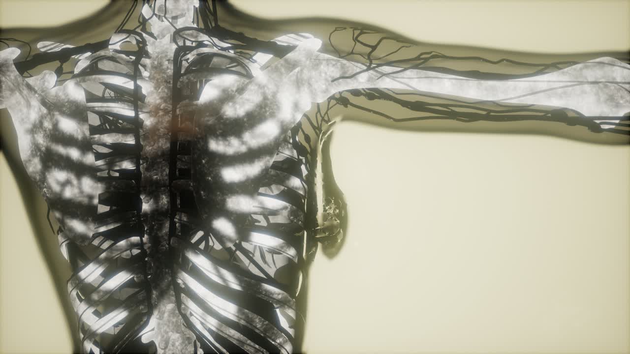 인간의 골격  ⁇  스캔 발광