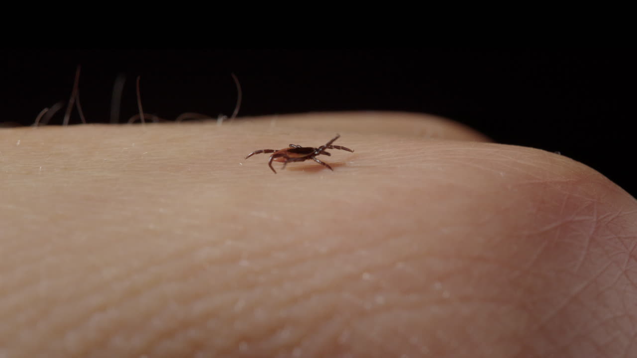 백인 인간 피부에 있는 진드기의 호기심 많은  ⁇ 기 움직임