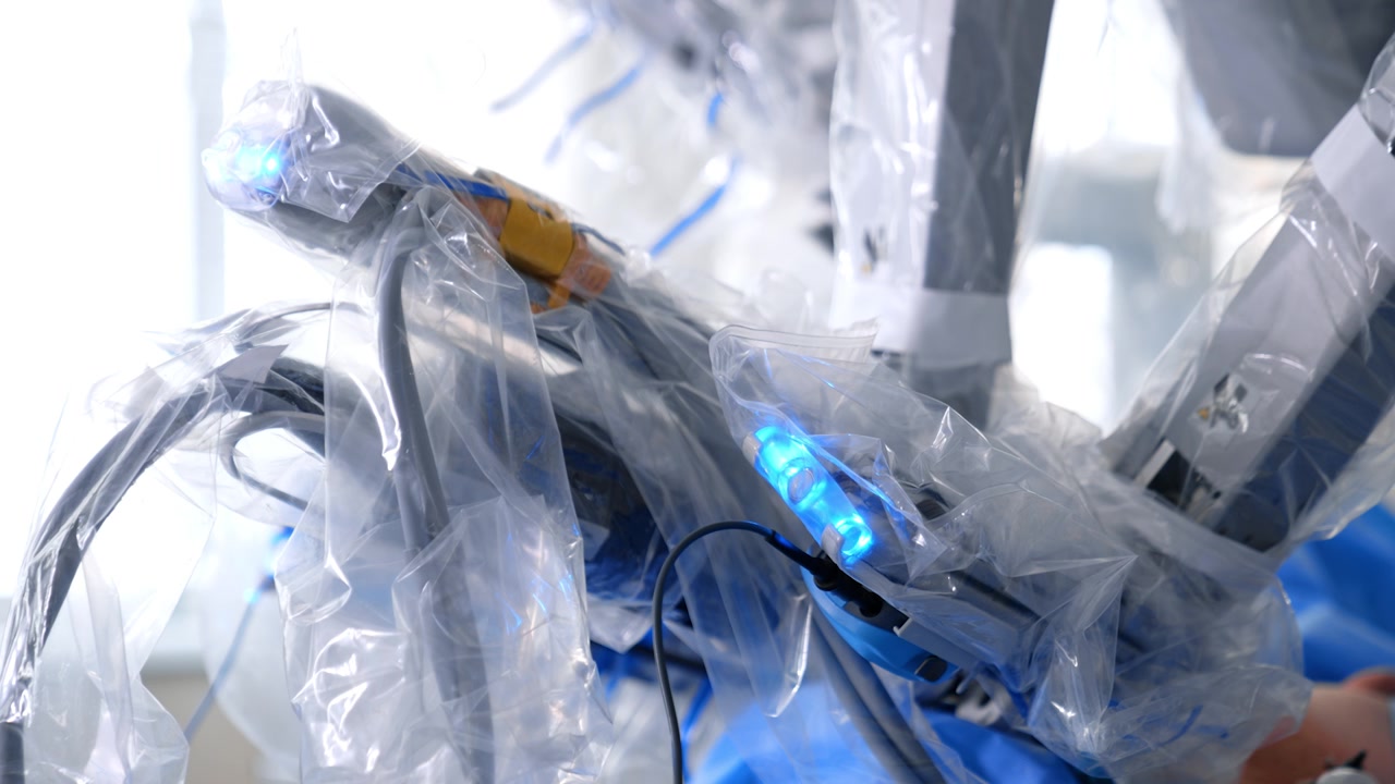Robotic manipulator arms input into the patient's abdomen move slowly. Da Vinci surgical system operates in modern hospital.