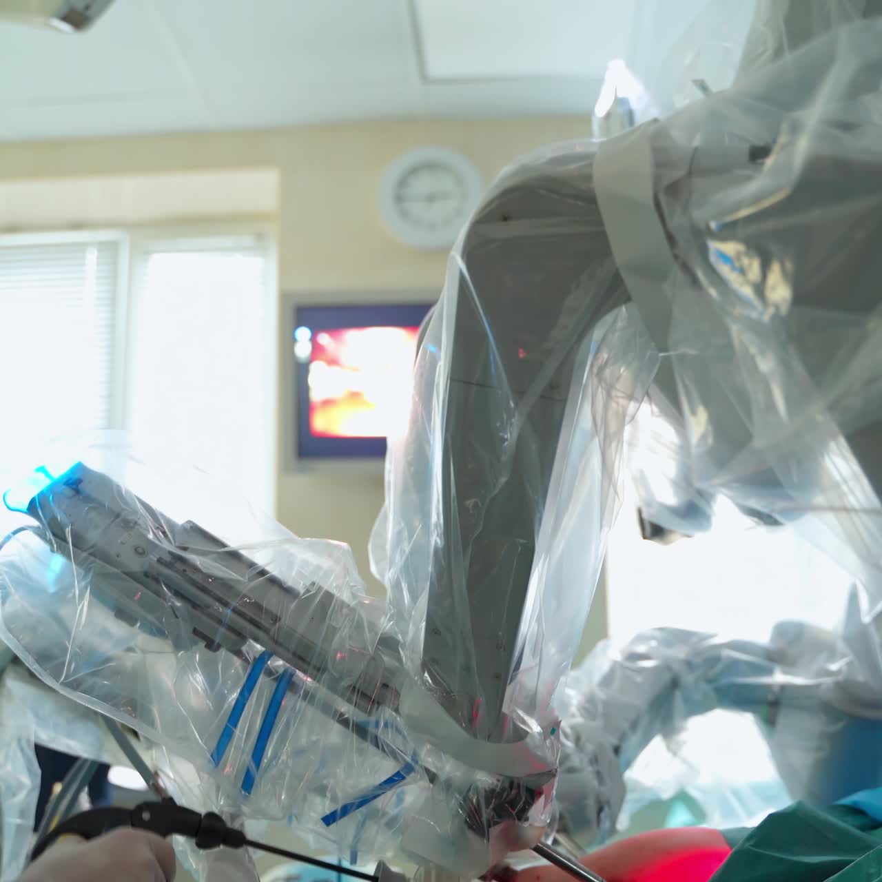 Work of robotic machine in the operating room. Female surgeon performing cancer removal surgery via minimally invasive robotic equipment. Hi-tech medical robot