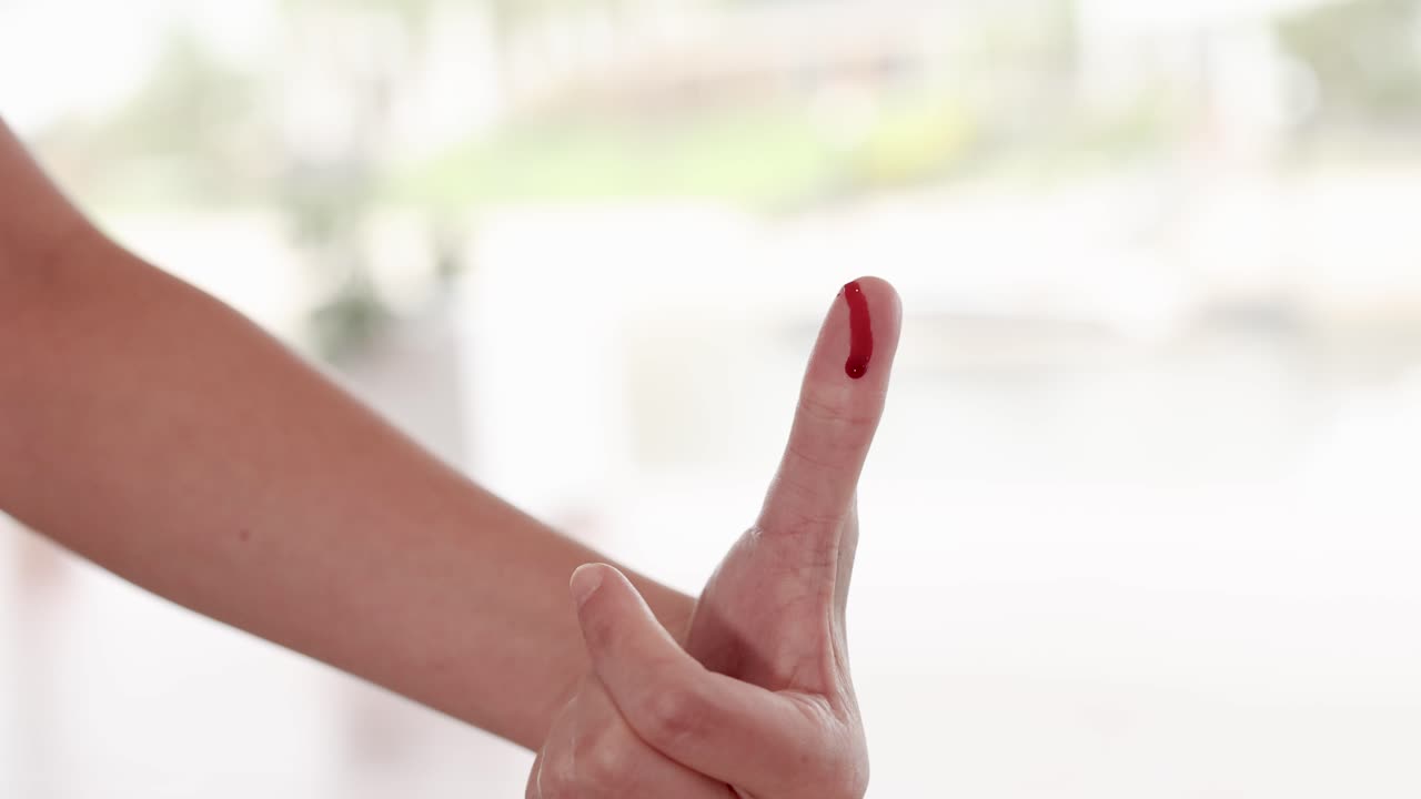 A hand with a bleeding thumb injury is shown in close-up, highlighting the wound and dripping blood
