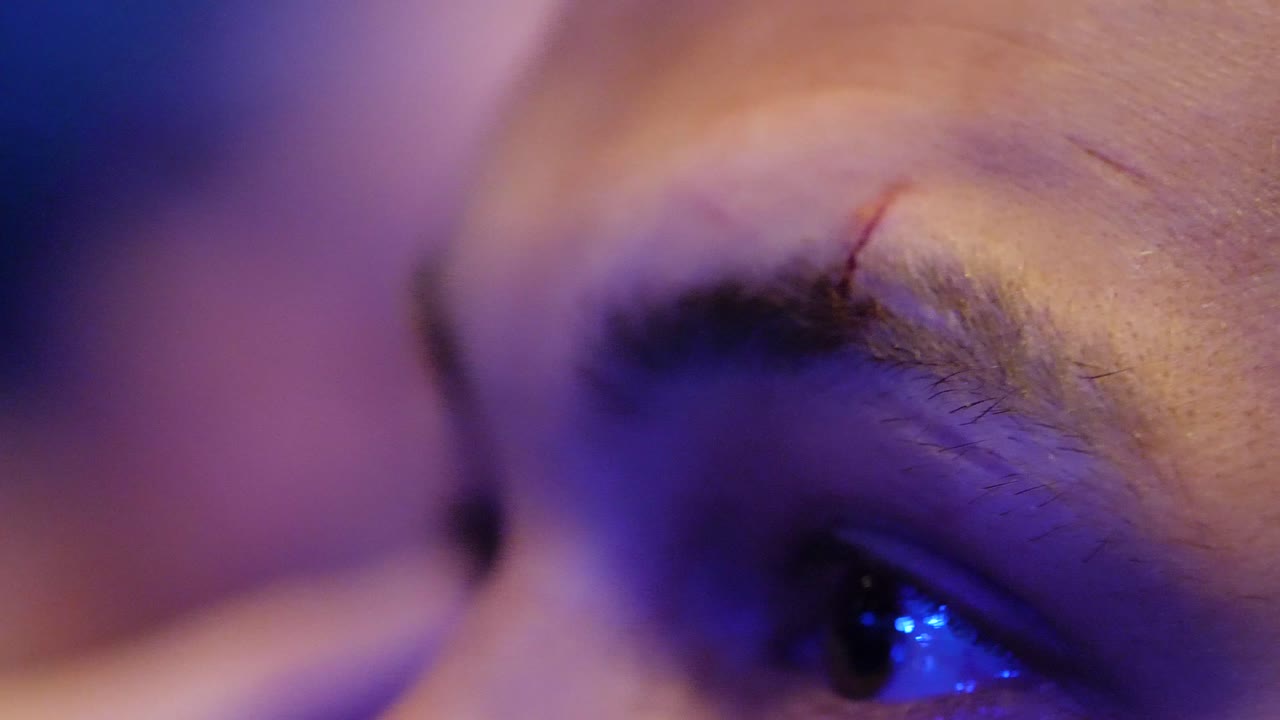 primer plano de la cara de una persona con una cicatriz