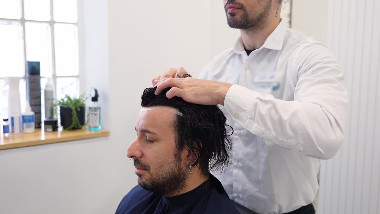 Procedimento di trapianto di capelli