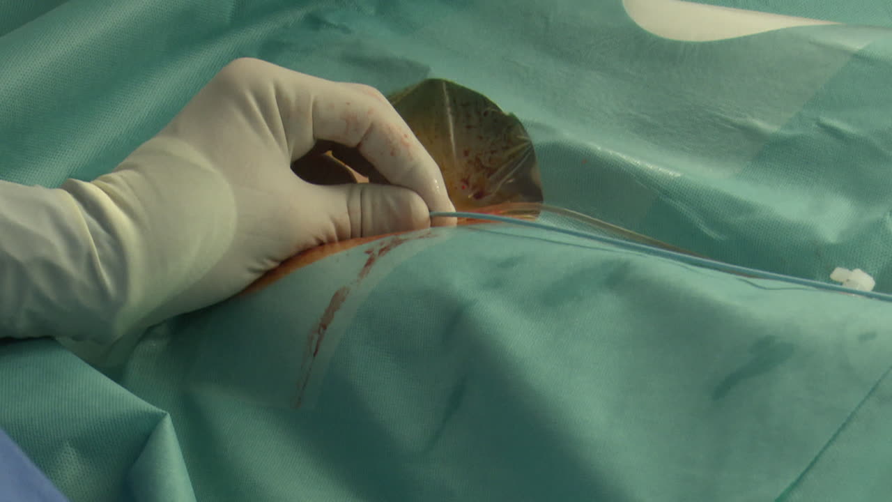 procedimiento quirúrgico