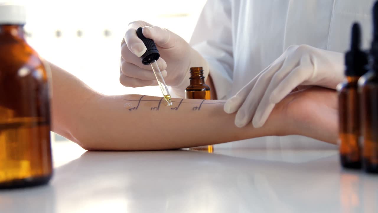 Close up of woman therapist doing allergy tests on her patient