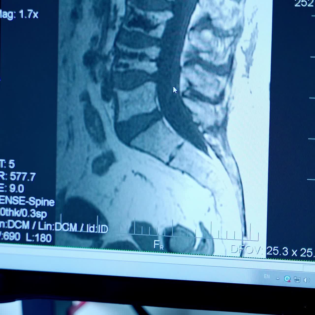 Neurologist Working On Personal Computer. Medical scientist working with scan images