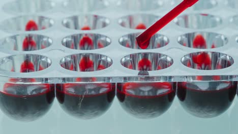 adding blood specimens with pipette to wells of microplate in laboratory