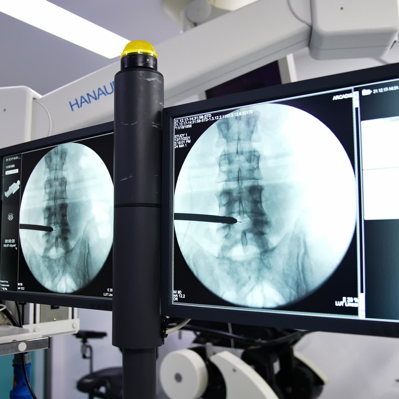Researchment medical health scanning. Screen medical monitoring