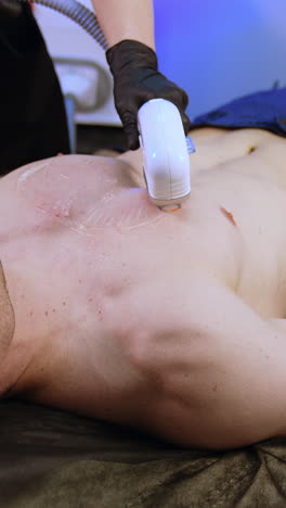 cosmetologist performs epilation to a man. beauty specialist uses elos laser epilator. vertical video
