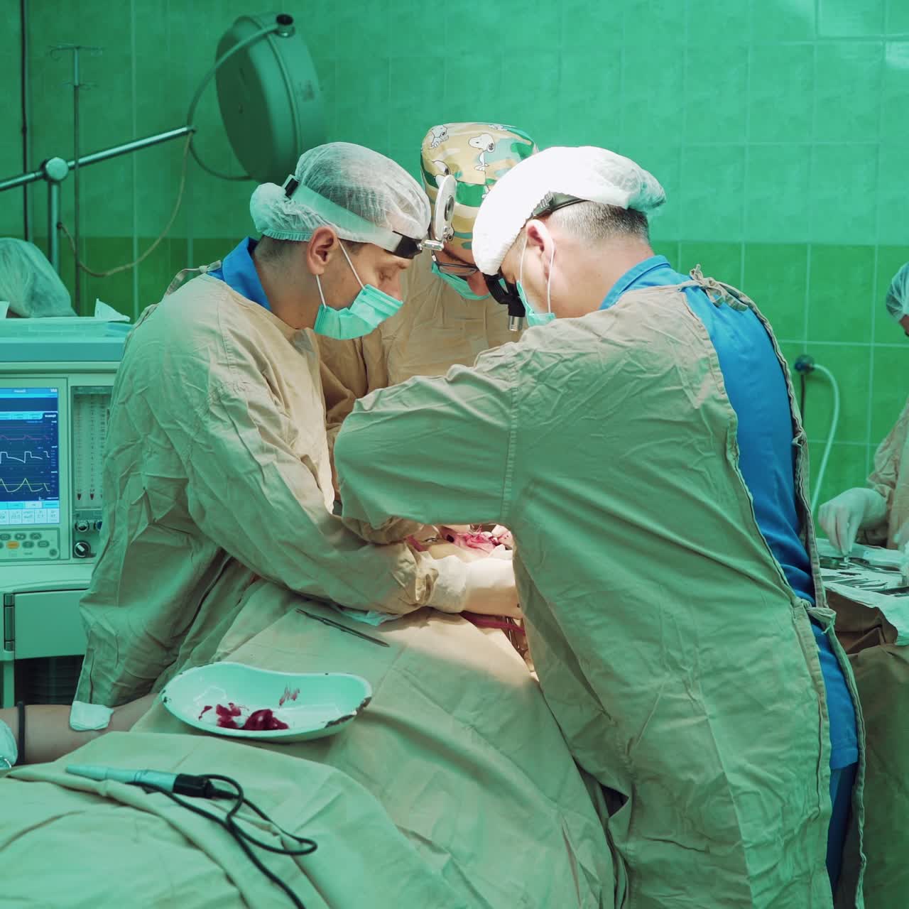 Medical team performing operation. Group of surgeon at work in operating theatre