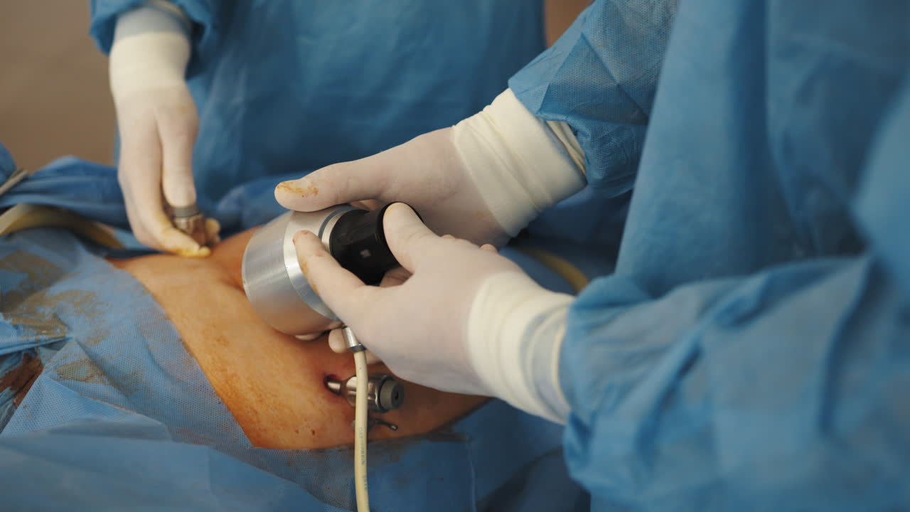 cirugía abdominal laparoscópica