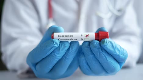 coronavirus blood sample test