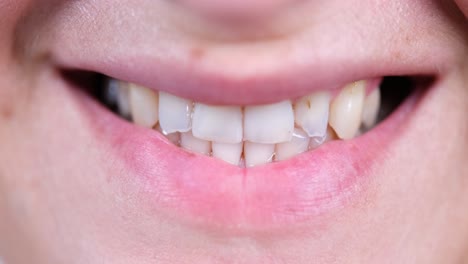 Close-up of a person smiling, showing teeth and lips
