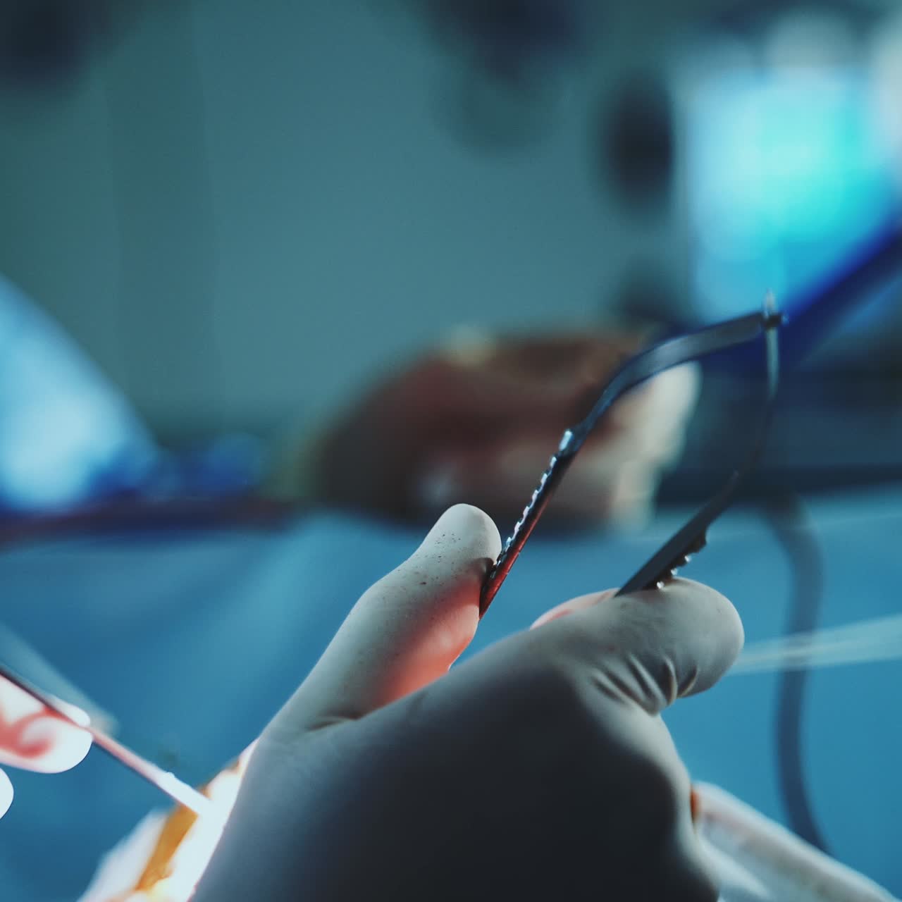 Gloved hands of a surgeon holding and operating the instruments. Doctor carefully moving the tools. Close up