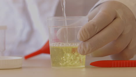 doctor prepares a urine specimen sample for analysis