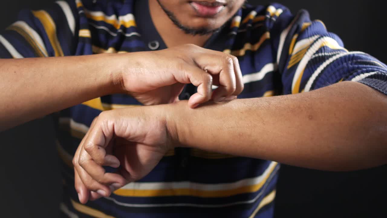 persona rascándose el brazo