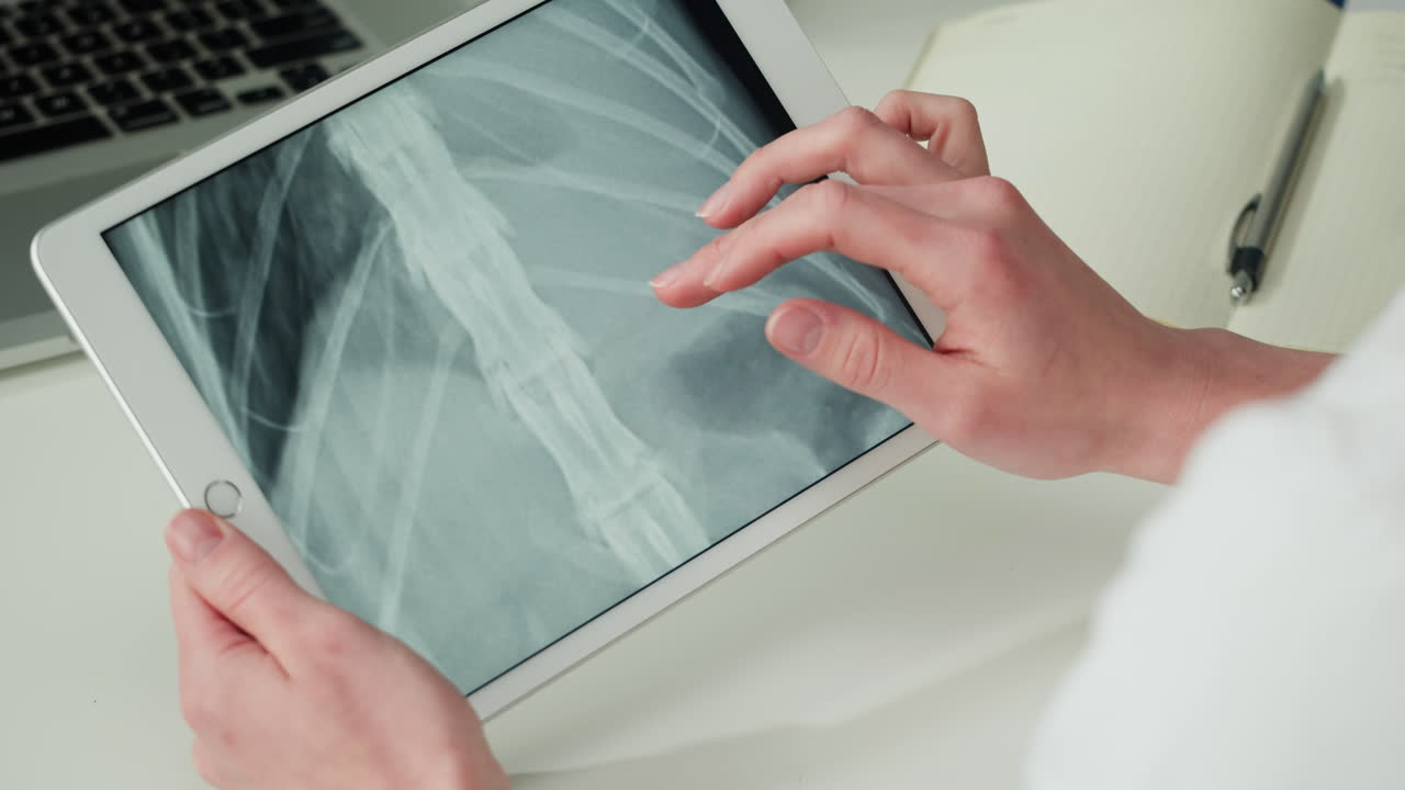 Medico che esamina una radiografia del torace su tablet