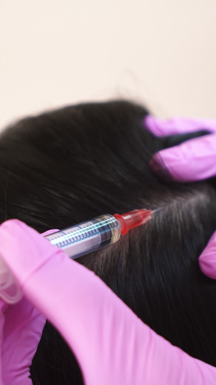 Beautiful young woman receives an injection in the head in the center of aesthetic medicine. Prevention and treatment of hair growth Vertical video