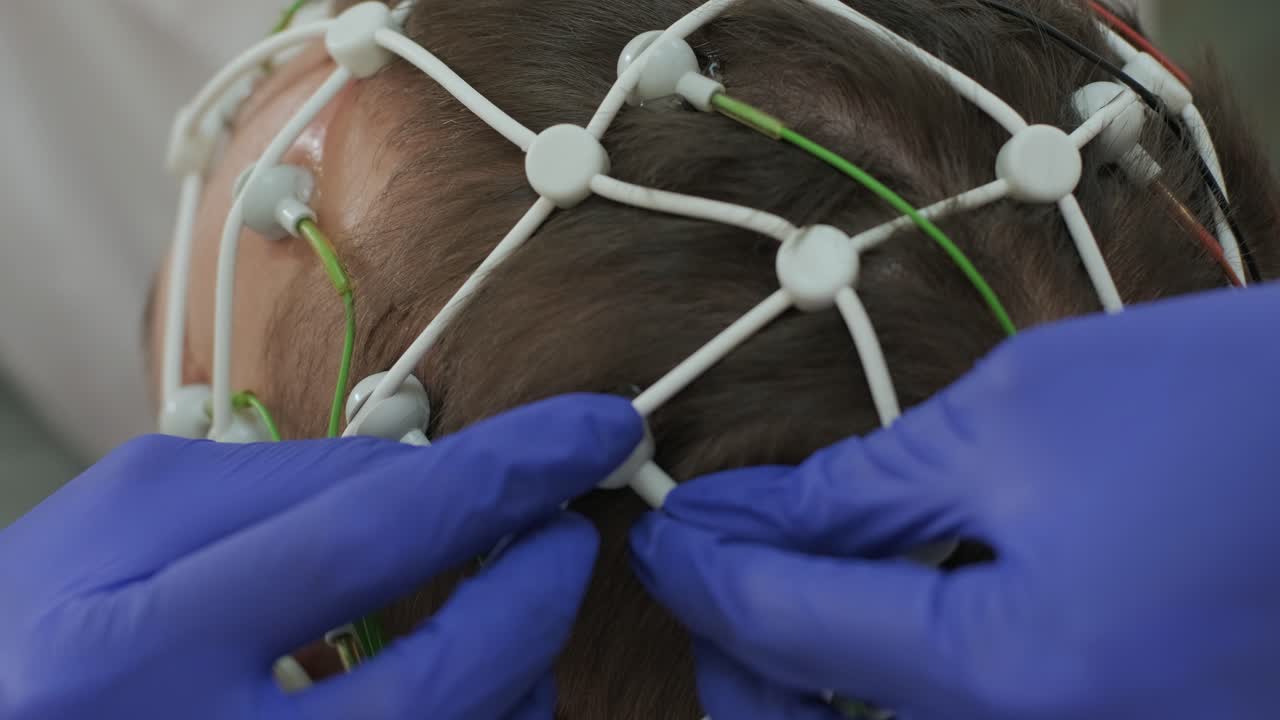 의료 센터에서 뇌 촬영을 사용하여 환자의 뇌 검사를 수행합니다.