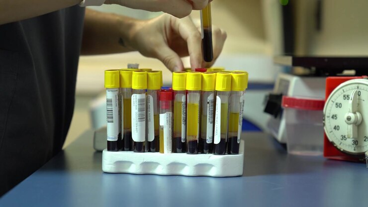 A lab technician handles blood sample tubes in a clinical analysis laboratory with modern equipment