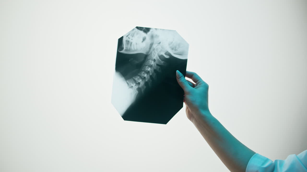 Primo piano di una mano che tiene una radiografia medica del collo e del cranio