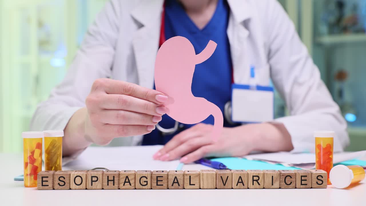 Doctor Explaining Esophageal Varices with Anatomical Model