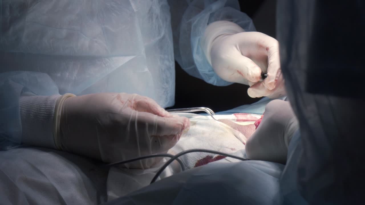 procedimiento quirúrgico