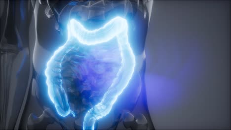 examen de radiología del colon humano