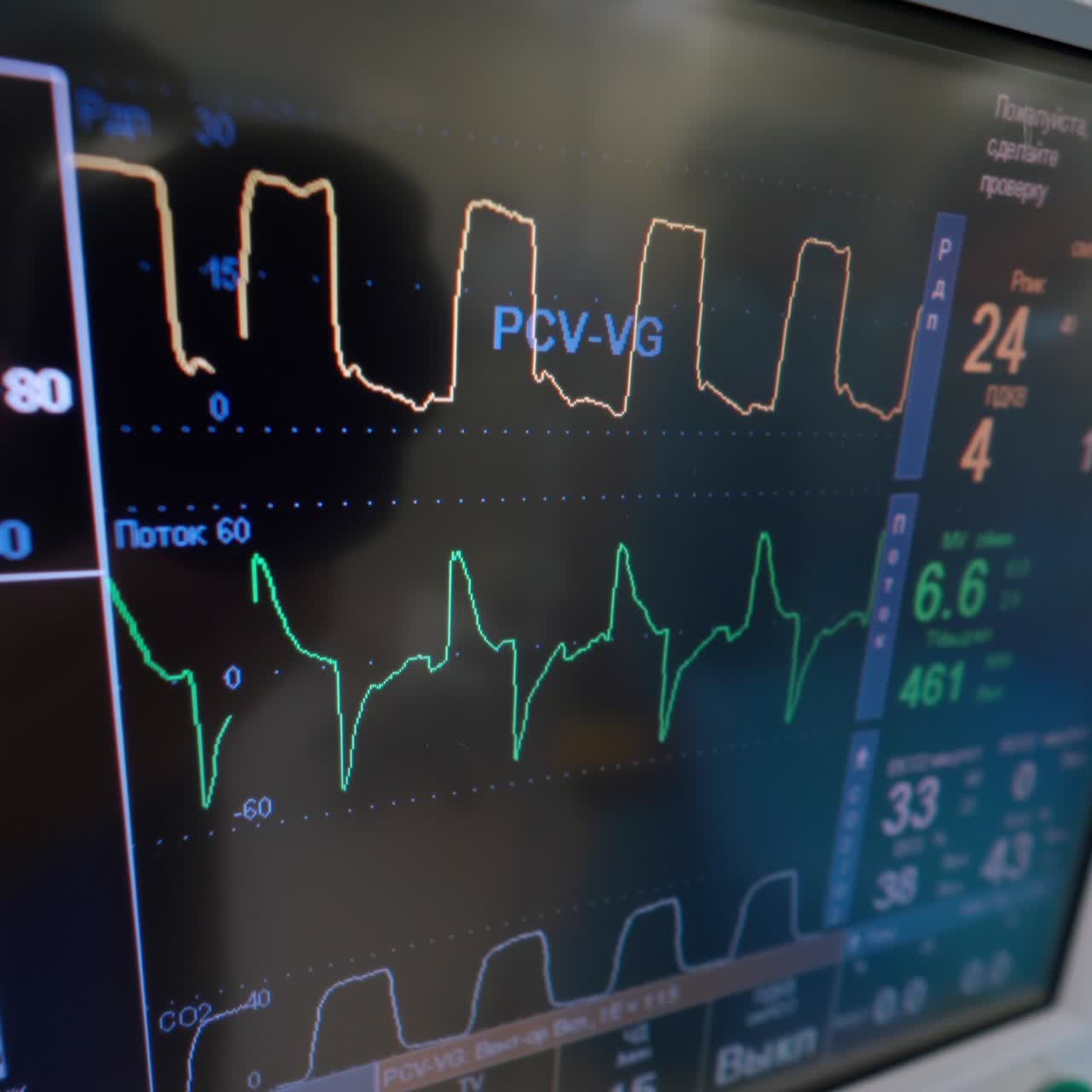 Patient's condition on monitor background. Artificial lung ventilation apparatus in hospital. Modern device shows the work of lungs. Close-up. Pandemic.