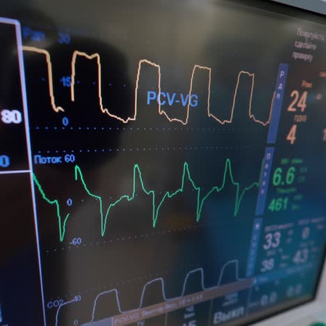 patient's condition on monitor background. artificial lung ventilation apparatus in hospital. modern device shows the work of lungs. close-up. pandemic.