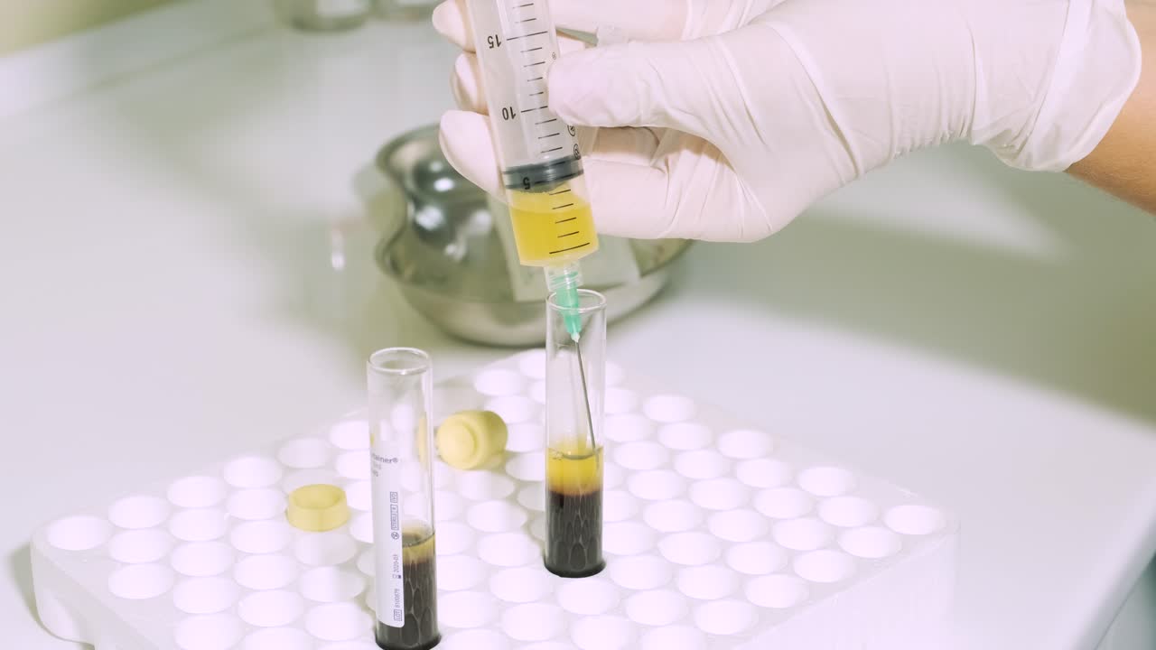 preparación de plasma rico en plaquetas. plasma en jeringa. centrifugadora. trasfondo