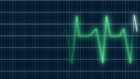 ekg heart rate electrocardiogram beeping then going flatline