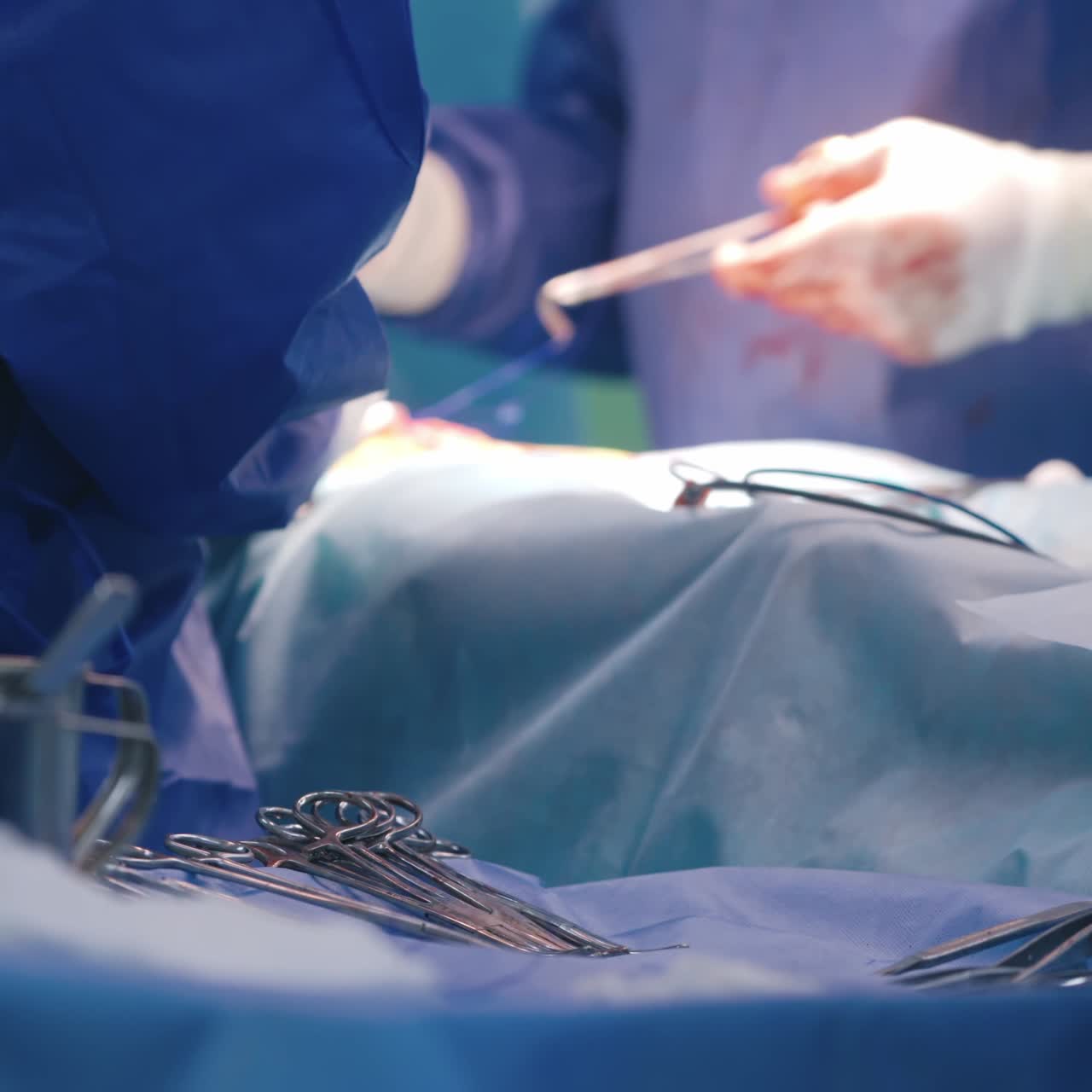 Process of making operation. Hands of doctors in blood during surgery. Medical instruments on the table. Close-up.