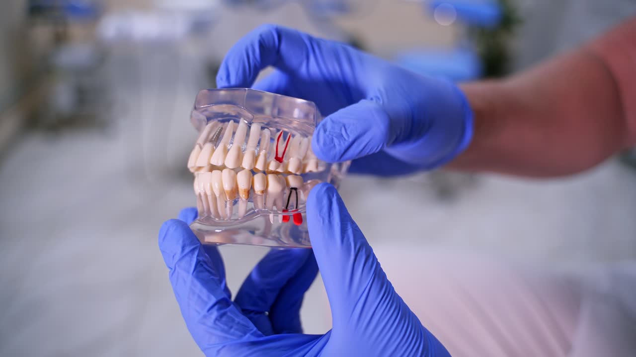Jaw model in dentist's hands. Dental implant laboratory. Artificial teeth in hands of stomatologist in hospital. Close-up