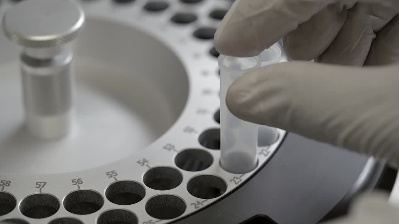 Medical Technician In Gloves Putting The Reactuon Tube On Sample Position Of Chemistry Analyzer