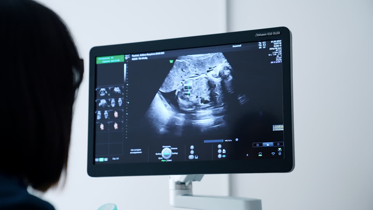 Dark-haired female doctor in glasses looking at the screen of ultrasonic equipment. Pregnancy check up at hospital.