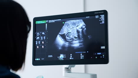 dark-haired female doctor in glasses looking at the screen of ultrasonic equipment. pregnancy check up at hospital.