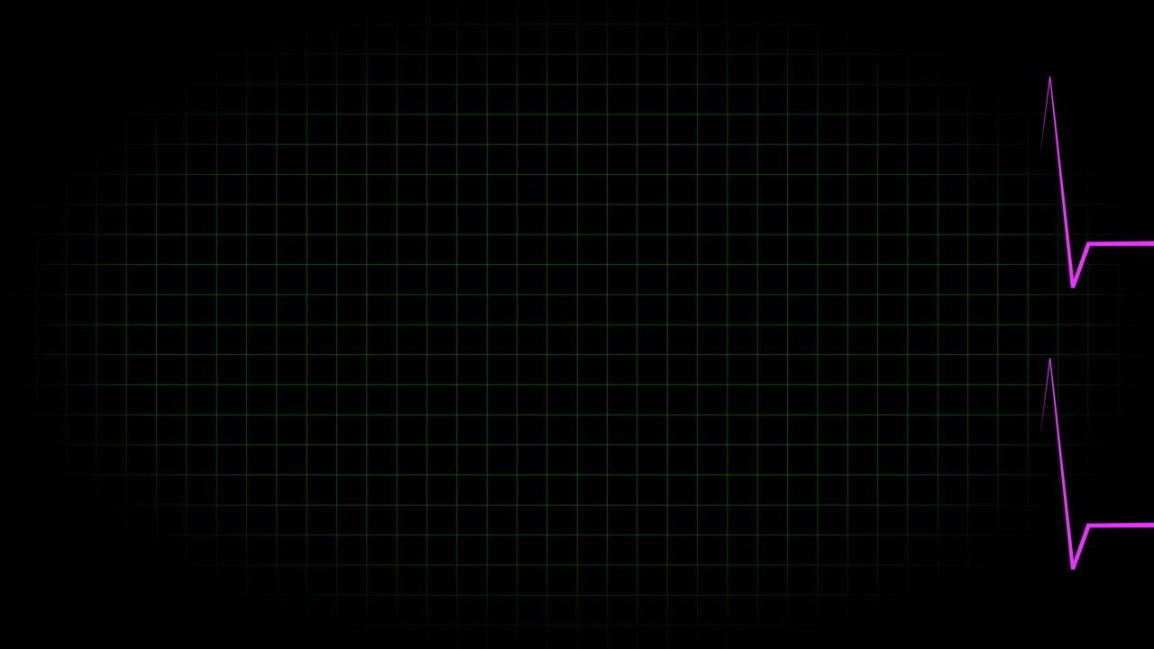 전기 심장 기록 오실로스코프 파동 형태 애니메이션 모션 그래픽