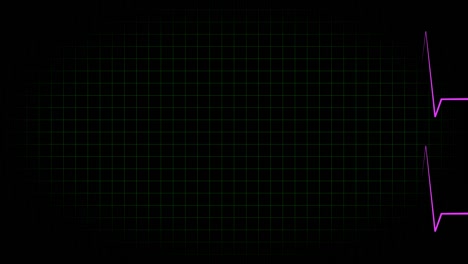 electrocardiograma osciloscopio forma de onda animación gráficos de movimiento