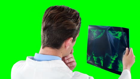 informe de radiografía del médico que lo examinó